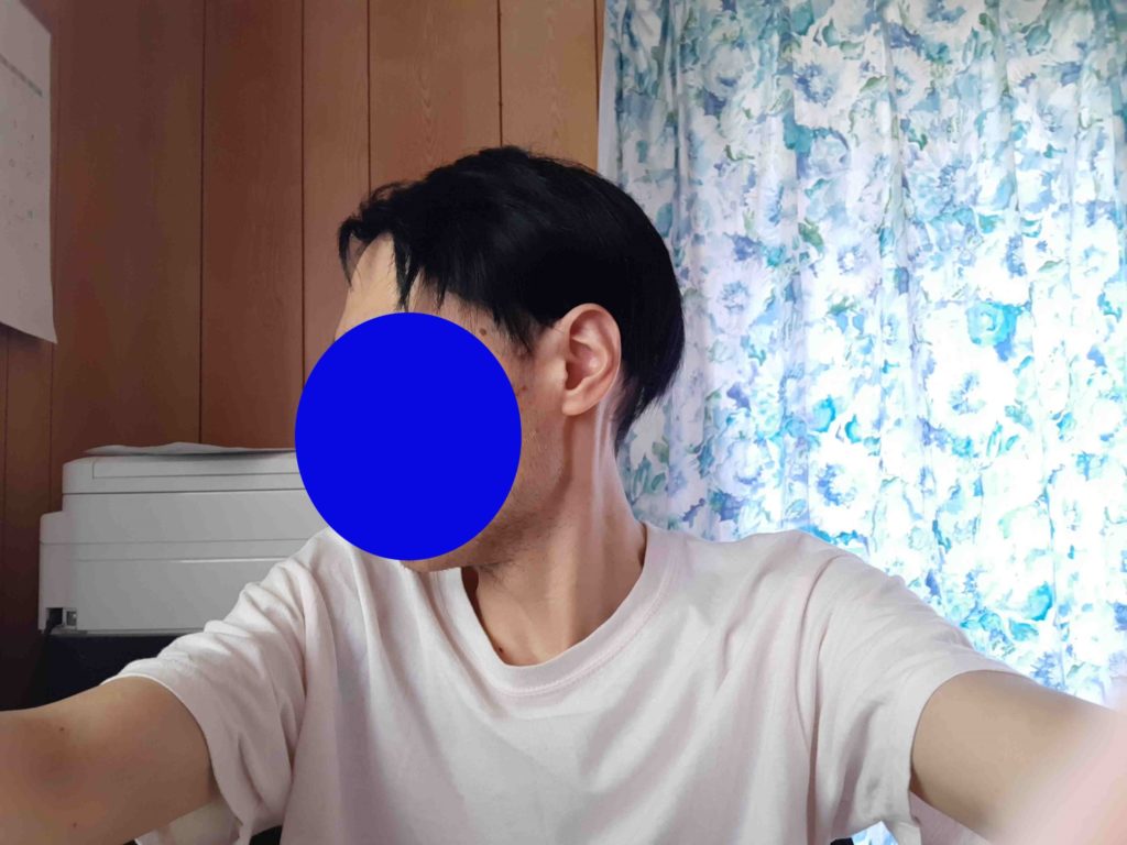 tefuRe 広範囲 ヘアピース 男性 部分ウィッグ 黒 メンズMY-341-Nbk　再び購入 